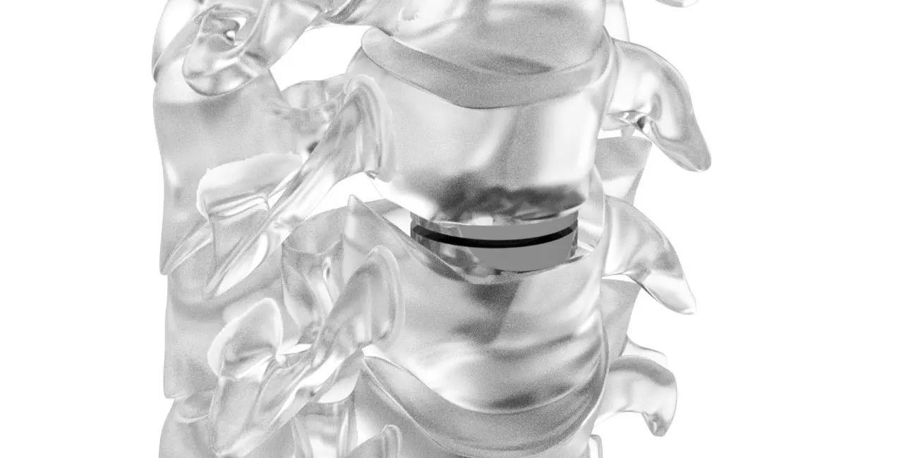Prótese de disco cervical