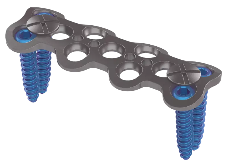 Placa Cervical Anterior Osteomed