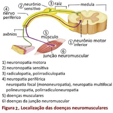 Doenças neuromusculares