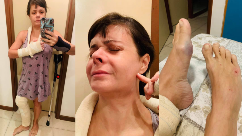 ‘Festa do corona’ termina com médica espancada