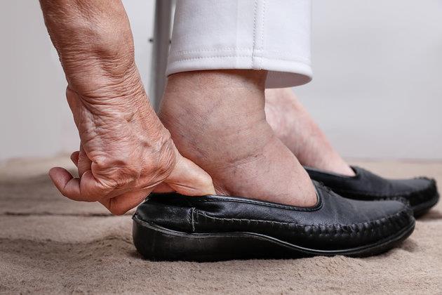 Inchaço nos pés: 5 possíveis causas do incômodo