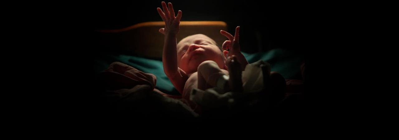 Bebê nasce com quatro pernas e três mãos
