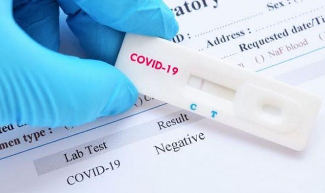 Farmácias de MT devem aplicar testes para Covid-19 neste mês por até R$ 250