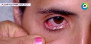 Mulher chora lágrimas de cristal, intriga médicos e diz 'dói demais'