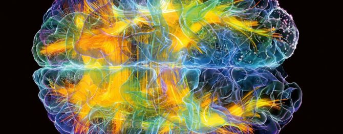 Conheça o cérebro artificial mais eficiente do mundo Conheça o cérebro artificial mais eficiente do mundo