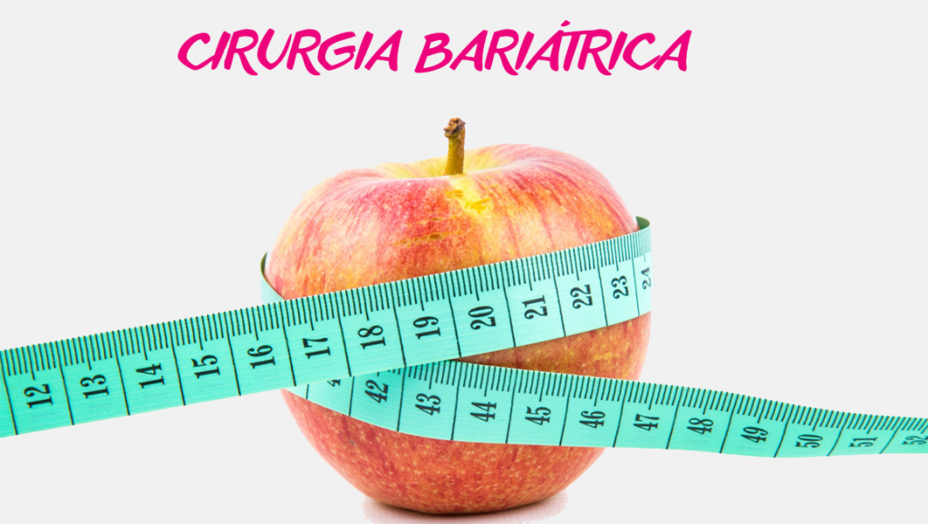 5 informações que você precisa saber antes de fazer uma cirurgia bariátrica