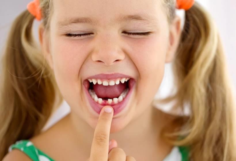 Queda dos dentes de leite: quais os cuidados necessários nessa hora?