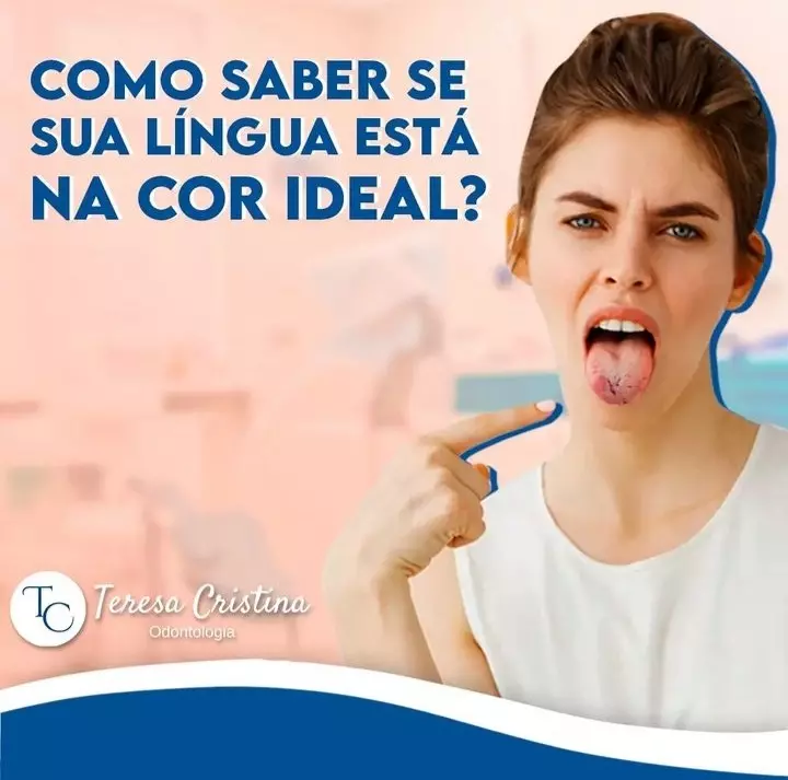 Qual a cor da sua língua?