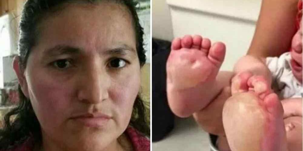 Babá fica irritada com bebê e queima seus pés em uma frigideira quente nos EUA