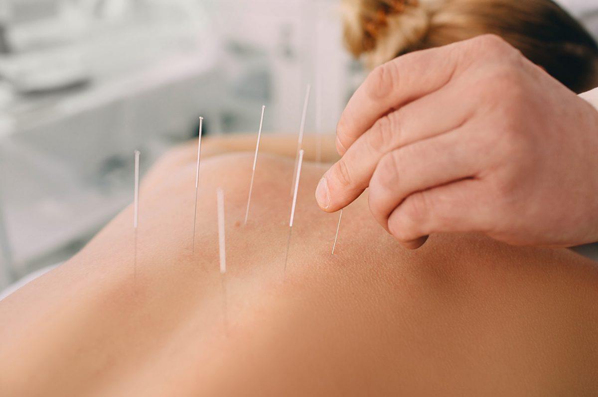 CNS recomenda divulgação de Práticas Integrativas e Complementares em Saúde na assistência ao tratamento do Covid-19: