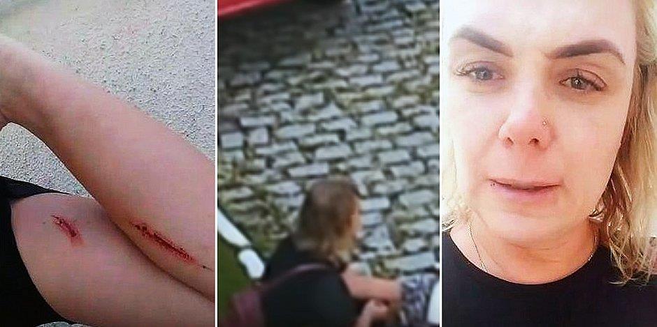 Ex-paquita se machuca antes de acusar ex-marido