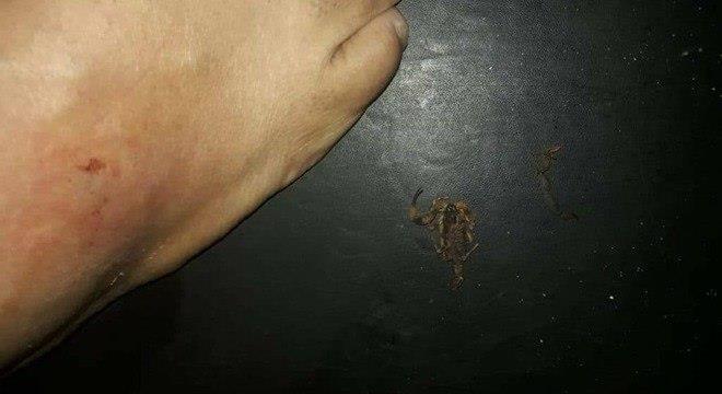 Homem é picado por escorpião dentro de cinema