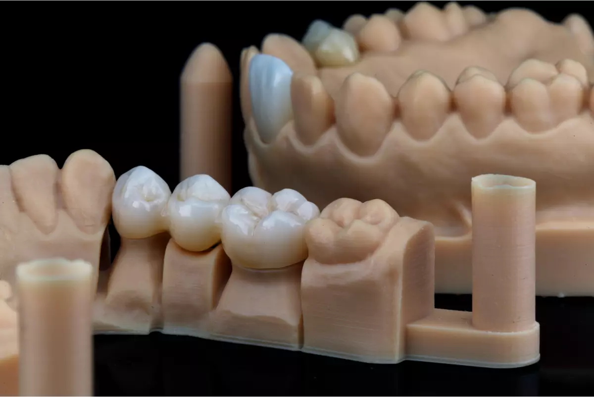 Prótese Dentária