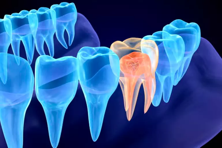 Endodontia